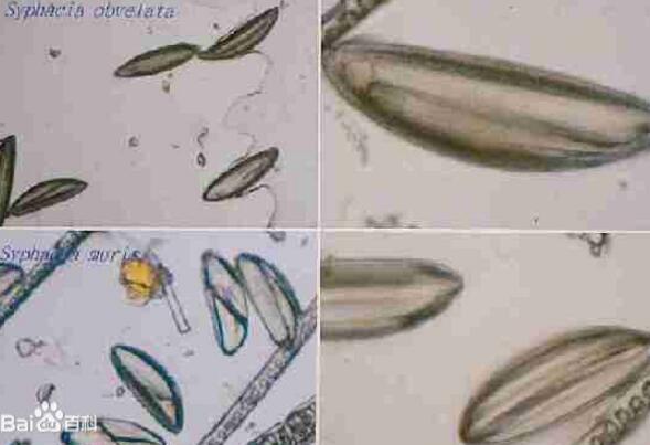 老太眼内8条活虫蠕动 线头状的白色虫子长约3厘米